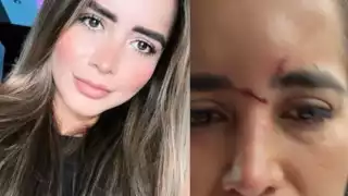 Citlaly Stefanía Rodríguez Palomeque le envió fotos a su hermano sobre los golpes que su pareja Gabriel Alejandro Zermeño en Guadalajara