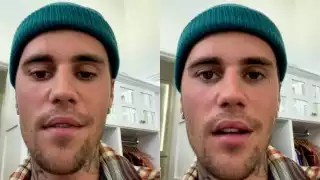 En el video que subió a Instagram, se ven las afectaciones de la parálisis facial que sufrió Justin Bieber, causado por el Síndrome de Ramsay Hunt