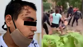 El agraviado mostró los moretones y heridas en su cuerpo tras la golpiza dada por policías estatales en Cancún