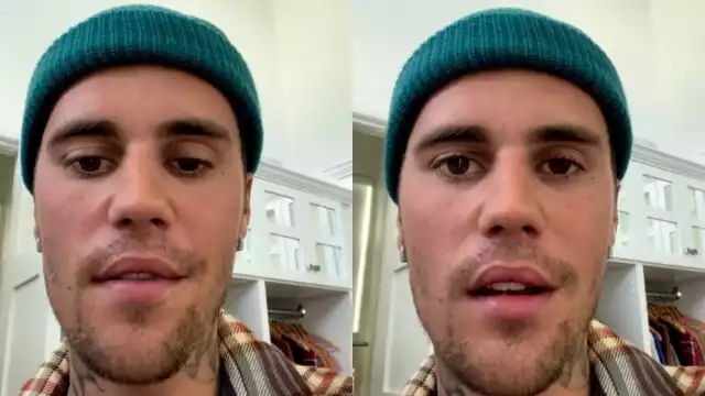 En el video que subió a Instagram, se ven las afectaciones de la parálisis facial que sufrió Justin Bieber, causado por el Síndrome de Ramsay Hunt