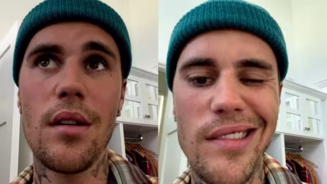 Justin Bieber mostró a sus fans la zona de la parálisis facial que sufrió y que lo obliga a cancelar una serie de conciertos ya pactados