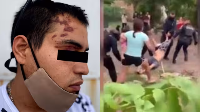 El agraviado mostró los moretones y heridas en su cuerpo tras la golpiza dada por policías estatales en Cancún