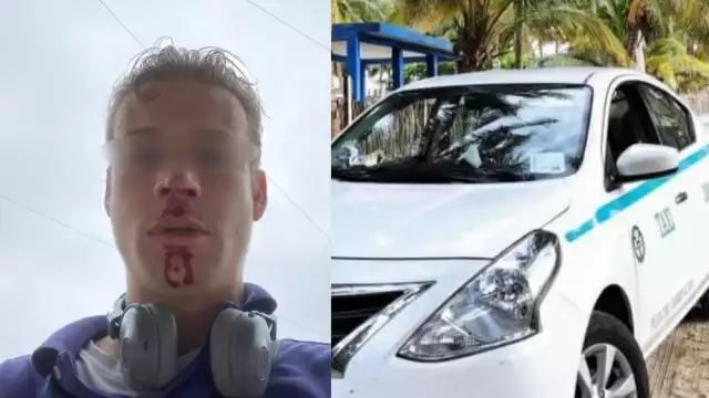 La pareja del agredido denunció en redes sociales el ataque que sufrió el hombre por parte de un taxista de Playa del Carmen