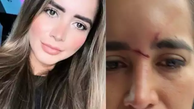 Citlaly Stefanía Rodríguez Palomeque le envió fotos a su hermano sobre los golpes que su pareja Gabriel Alejandro Zermeño en Guadalajara