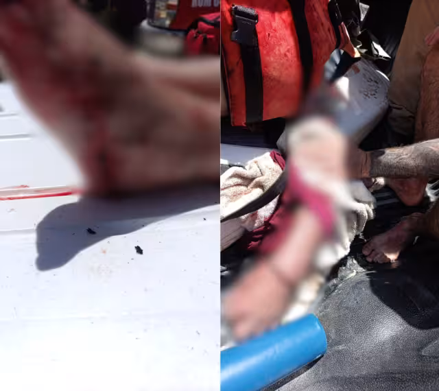 Paramédicos de Protección Civil, quienes brindaron los primeros auxilios al turista lesionado y posteriormente lo trasladaron a un hospital.