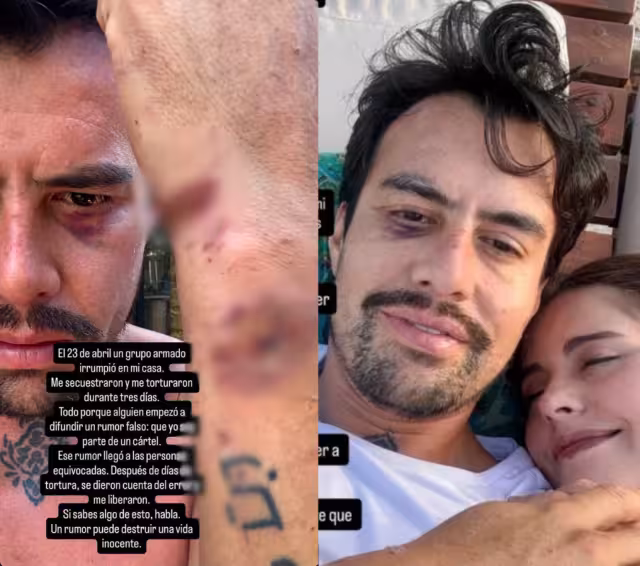 La víctima aseguró que fue secuestrada y torturada por un grupo armado tras ser confundido por un rumor falso