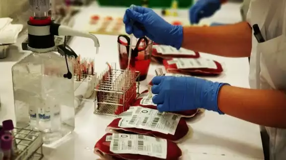 Los donadores son sometidos a una Prueba de Proteína Reactiva Foto: Jorge Delgado