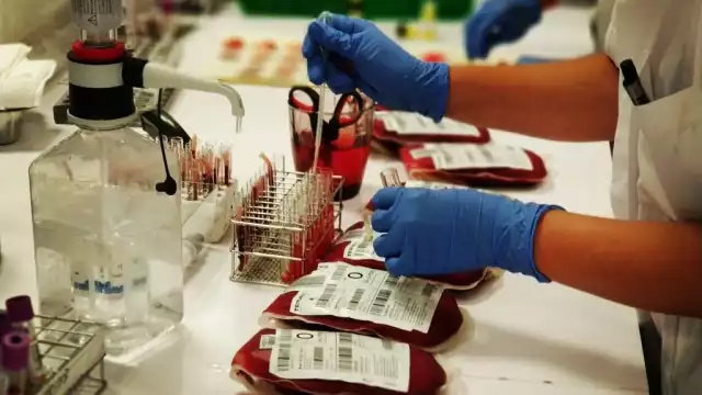 Los donadores son sometidos a una Prueba de Proteína Reactiva Foto: Jorge Delgado