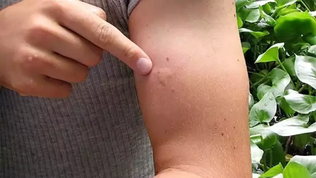 Yucatán se ubica en el segundo lugar a nivel nacional con más casos de dengue