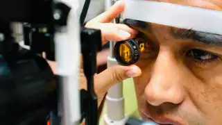 Conjuntivitis 'arrasa' en Yucatán; hay 40 contagios cada 24 horas