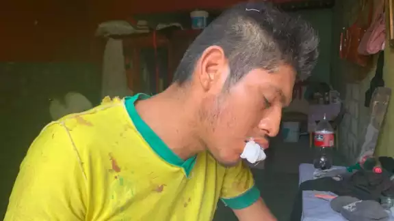EL joven fue auxiliado por dos personas quienes le ayudaron levantarse EL joven fue auxiliado por dos personas quienes le ayudaron levantarse