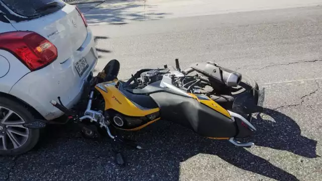 El motociclista solamente presentó golpes en el rostro