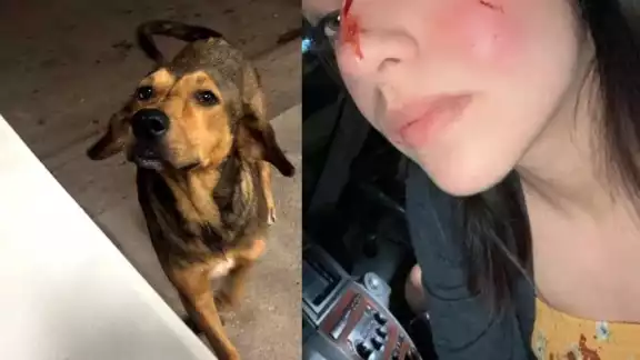 A través de dos cuentas en Facebook, bajo el nombre de “Roma Puente” y "Ana Vizcarra", divulgó fotografías de las lesiones que le provocó el can