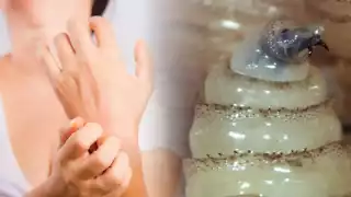 Tercer caso de miasis humana en Campeche por gusano barrenador preocupa a Salud