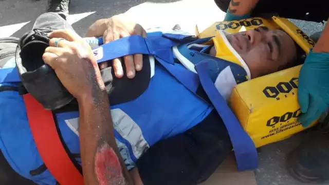 Repartidor de pizza es impactado por una mujer