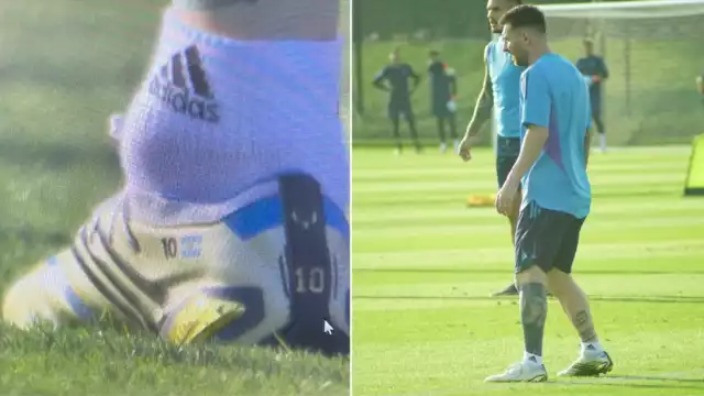 Messi tiene un pequeño bulto en su pie derecho, que se hizo visible durante el entrenamiento de esta mañana.