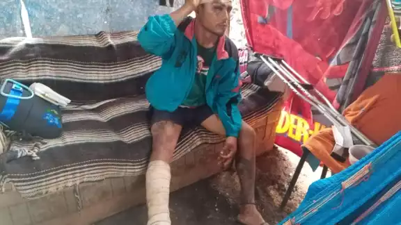 El joven espera que el alcalde municipal le ayude en su situación y le brinden el apoyo El joven espera que el alcalde municipal le ayude en su situación y le brinden el apoyo