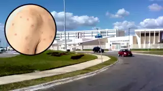 Hasta hoy, del total de defunciones, tres son de la CDMX, una de Baja California y una en la Entidad