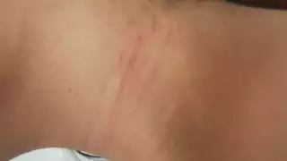 El maleante intentó despojarla de su ropa, dejándole rasguños