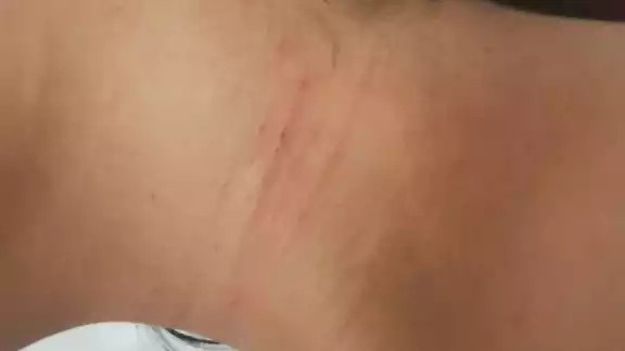 El maleante intentó despojarla de su ropa, dejándole rasguños El maleante intentó despojarla de su ropa, dejándole rasguños