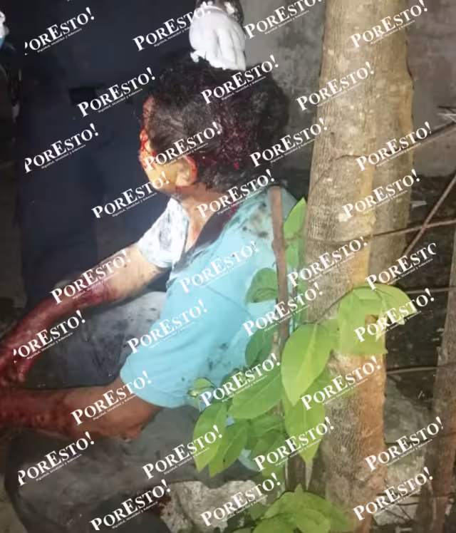 El hombre fue atendido por paramédicos, luego de registrar un fuerte golpe en la cabeza