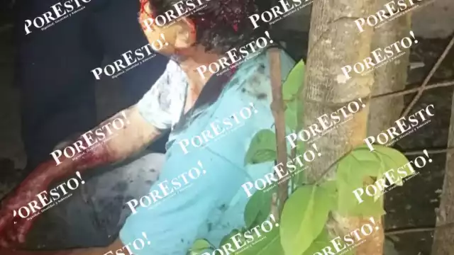 El hombre fue atendido por paramédicos, luego de registrar un fuerte golpe en la cabeza