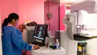 Uno de los servicios serán estudios de mastografías