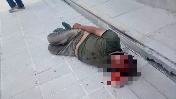 Tras el golpe, el exfuncionario se quedó en el piso, acostado, esperando ser atendido