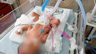 La Tasa Nacional de Incidencia en recién nacidos portadores del virus es de 90.88 por cada 100 mil recién nacidos vivos