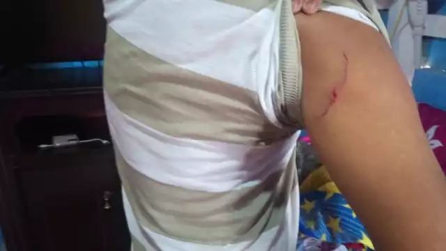 Hirieron a una de sus víctimas con arma blanca para revelar dónde se encontraba el dinero