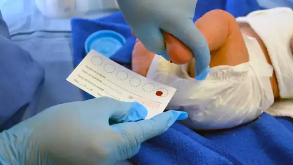 En el IMSS se realizan alrededor de 427 mil pruebas al año a bebés derechohabientes En el IMSS se realizan alrededor de 427 mil pruebas al año a bebés derechohabientes