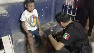 Pitbull muerde en las piernas a un niño en Valladolid