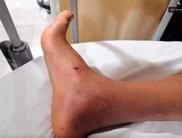 Las afectaciones se producen cuando los insectos o alimañas inoculan toxinas en el organismo y provocan una serie de alteraciones fisiopatológicas