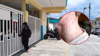 Refuerzan protocolos en escuelas de Quintana Roo tras confirmar 10 casos de sarampión