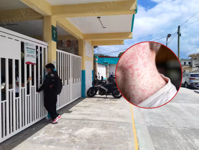 Como parte del protocolo preventivo, autoridades educativas insistieron a los padres de familia llevar a sus hijos a las jornadas de inmunización gratuitas