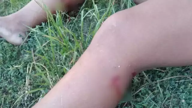 La joven mamá tuvo que se trasladada al Hospital General de Cozumel debido a la gravedad de las heridas