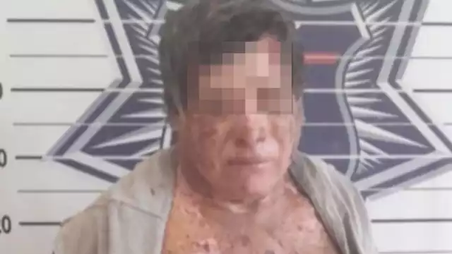 El hombre se lesionó en la cabeza luego de tropezar al intentar huir