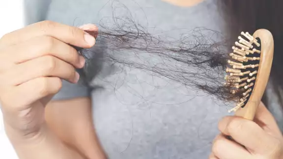 La alopecia no es un tema solo de hombres. Foto: Especial. La alopecia no es un tema solo de hombres. Foto: Especial.
