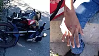 El motociclista fue trasladado al IMSS de Izamal