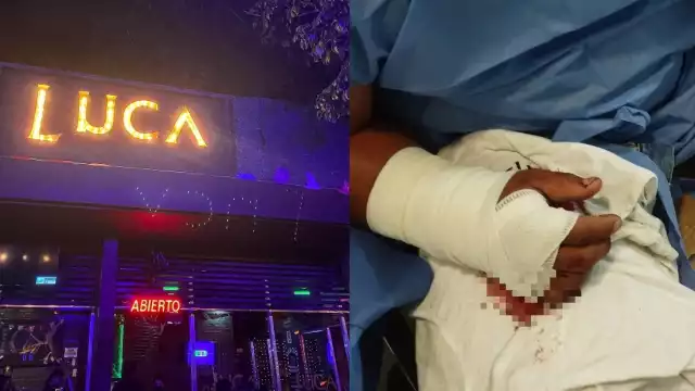 La víctima tendrá que ser intervenido quirúrgicamente debido a los golpes que recibió