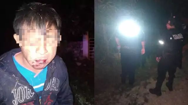 El hombre resultó con heridas en el cuerpo y rostro