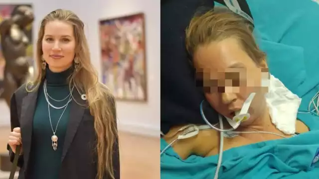 Anna Kurmanova se encuentra presuntamente en el hospital O'Horán de Mérida