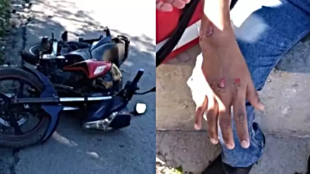 El motociclista fue trasladado al IMSS de Izamal