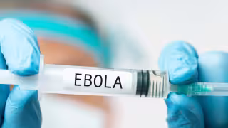 ¿Qué es el ébola y cómo se contagia? Así se previene esta peligrosa enfermedad