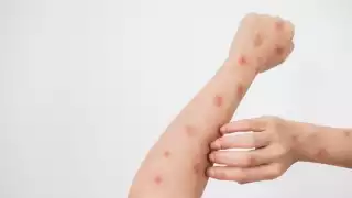 Es el primer caso reportado en la ciudad de Kanasín