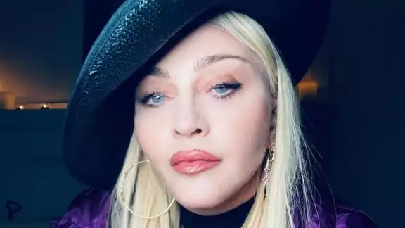 Madonna ha sido criticada por sus múltiples cirugías en los últimos meses. Foto: Especial
