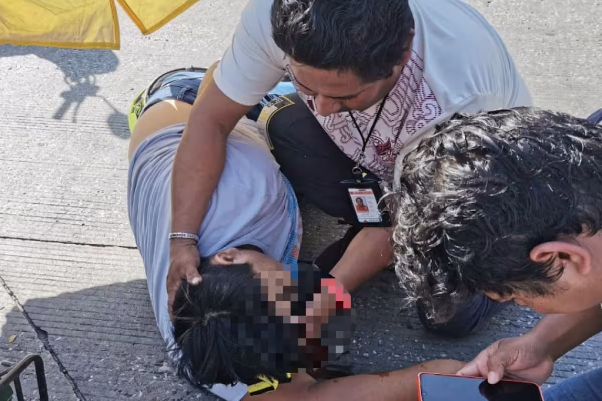 Motociclista de Ciudad del Carmen choca contra un auto en sentido ...