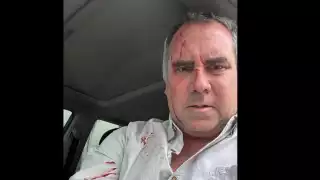 Atentado contra Rafael Belaúnde en Lima: el precandidato presidencial sale ileso tras ataque a balazos