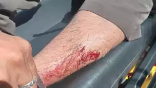 Lo subieron a una ambulancia de traslado del municipio para ser trasladado al Hospital General Agustín O’Horán de Mérida