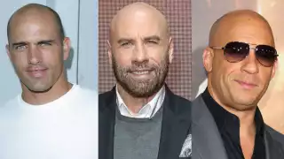 Su calvicie no acompleja a estos famosos. Foto:Especial